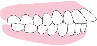 矯正歯科 大阪なら 大阪矯正歯科グループ