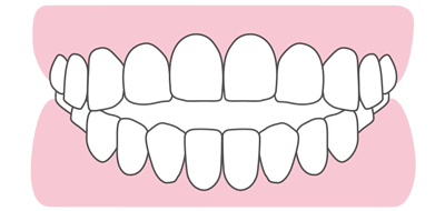 矯正歯科 大阪なら 大阪矯正歯科グループ