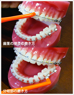 歯茎の境目の磨き方