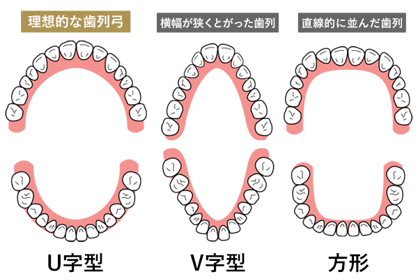 理想 的 な 歯並び