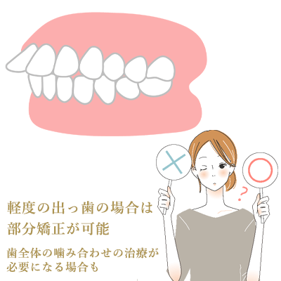 部分矯正で出っ歯は治る？