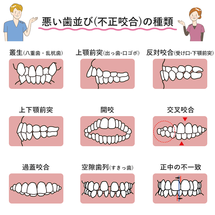 あなたの歯並びはどのタイプ 不正咬合の種類 クローバー歯科クリニック併設 大阪矯正歯科グループ