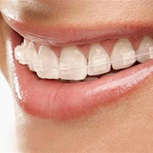 �z���C�g���C���[