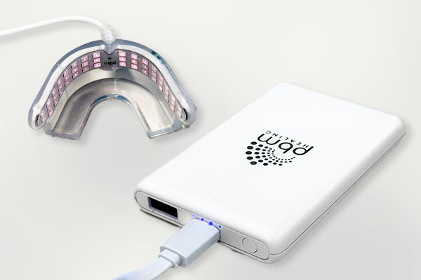 日本メーカー新品 光加速装置 PBM healingオルソ インビザライン
