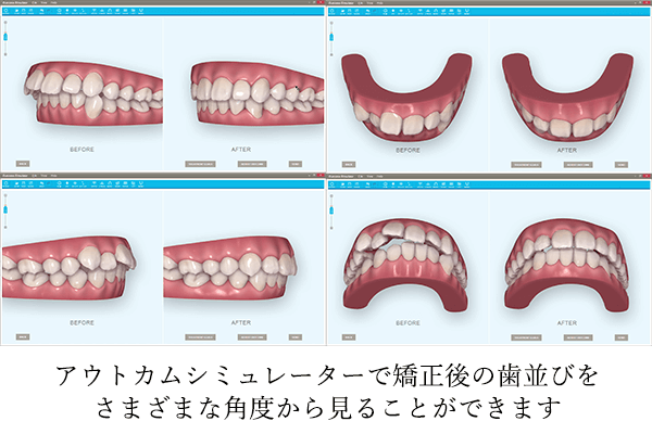 V~[V