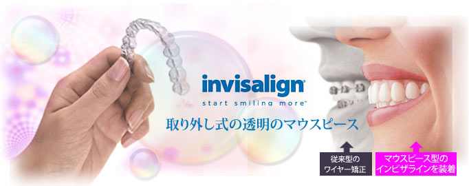 inbisalign CrUC