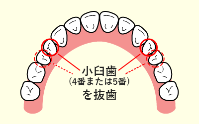 鎕̐