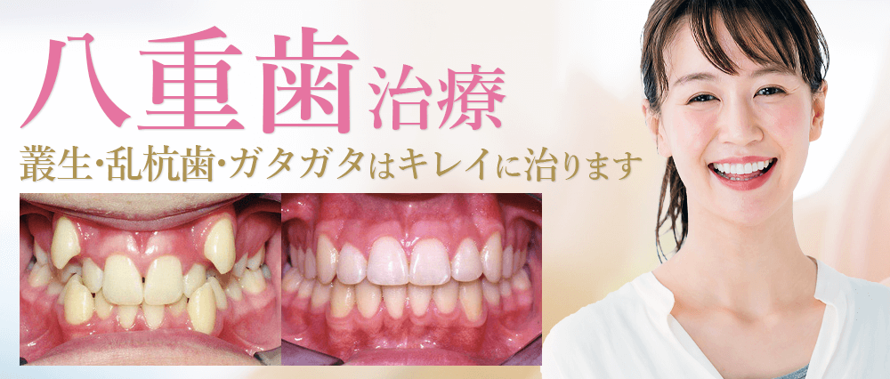 八重歯治療