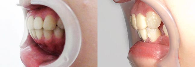 Ǘ