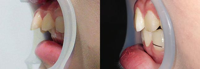 Ǘ