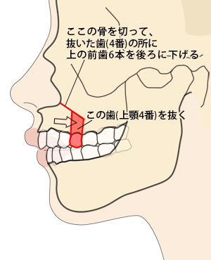 ゠ZbgobNioj