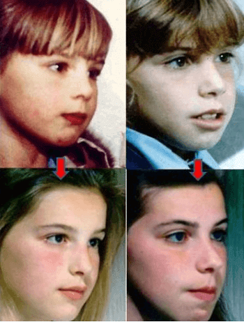 口呼吸と鼻呼吸