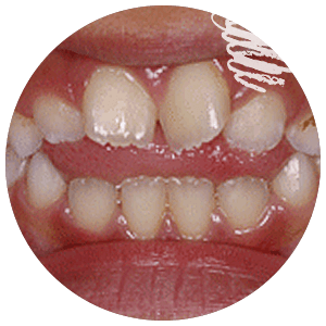 話していると舌が出る