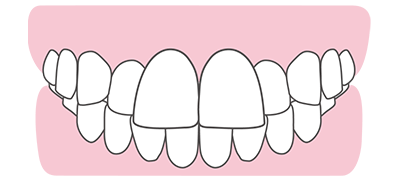 前歯が大きい